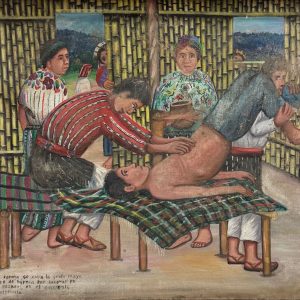 Mayan Hernia Treatment